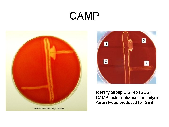 CAMP Identify Group B Strep (GBS) CAMP factor enhances hemolysis Arrow Head produced for