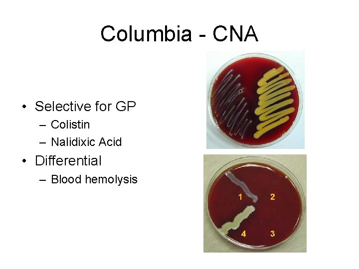 Columbia - CNA • Selective for GP – Colistin – Nalidixic Acid • Differential