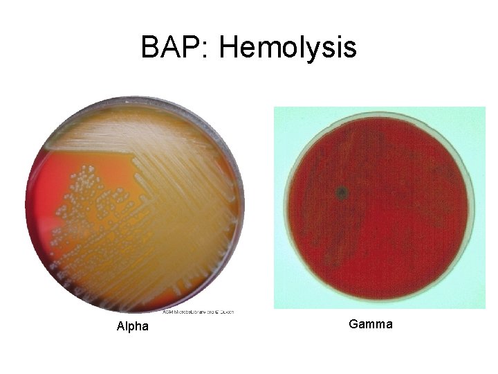 BAP: Hemolysis Alpha Gamma 