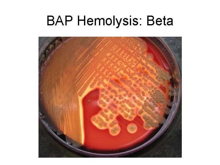 BAP Hemolysis: Beta 