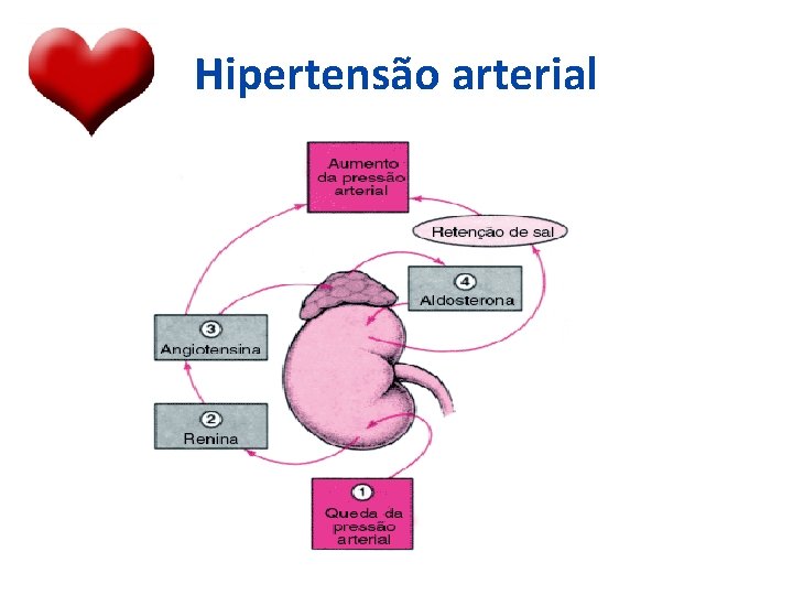 Hipertensão arterial 