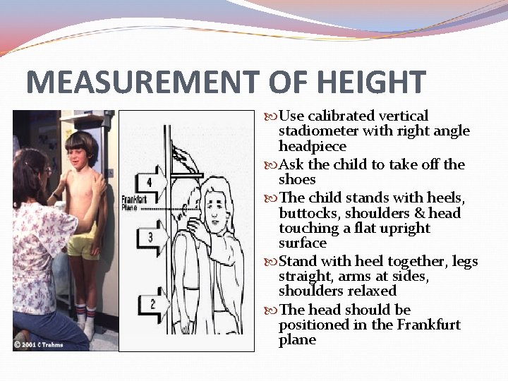 MEASUREMENT OF HEIGHT Use calibrated vertical stadiometer with right angle headpiece Ask the child