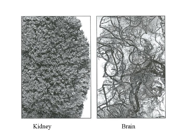 Kidney Brain 
