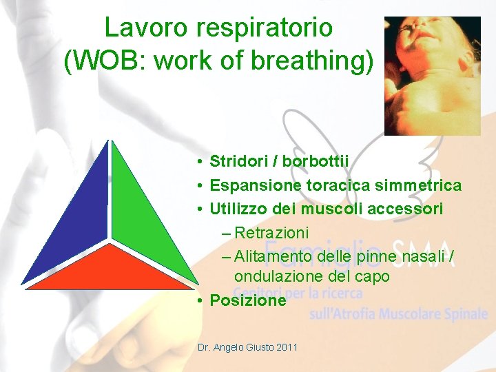 Lavoro respiratorio (WOB: work of breathing) • Stridori / borbottii • Espansione toracica simmetrica