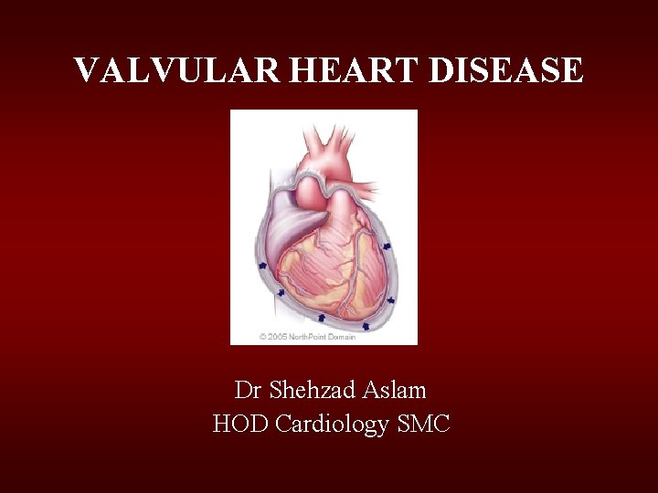 VALVULAR HEART DISEASE Dr Shehzad Aslam HOD Cardiology SMC VALVULAR HEART DISEASE Dr Shehzad Aslam HOD Cardiology SMC