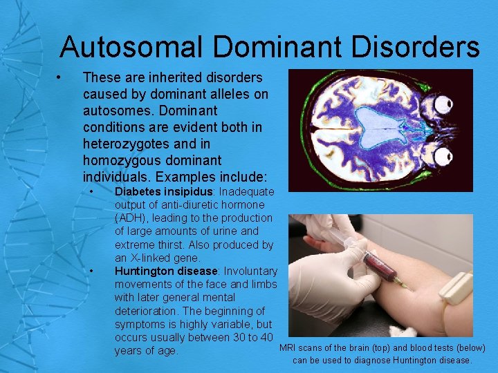 Autosomal Dominant Disorders • These are inherited disorders caused by dominant alleles on autosomes.