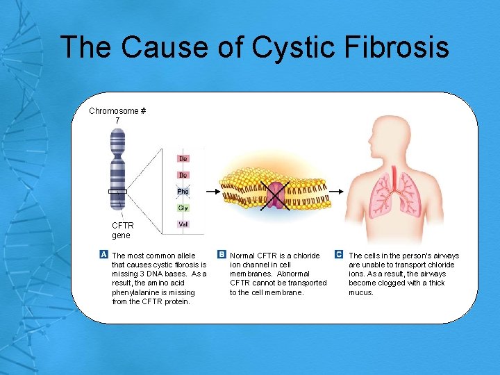 The Cause of Cystic Fibrosis Chromosome # 7 CFTR gene The most common allele