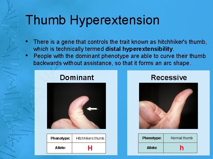 Thumb Hyperextension • • There is a gene that controls the trait known as