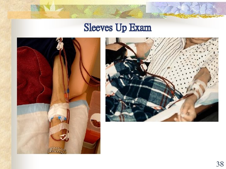 Sleeves Up Exam 38 