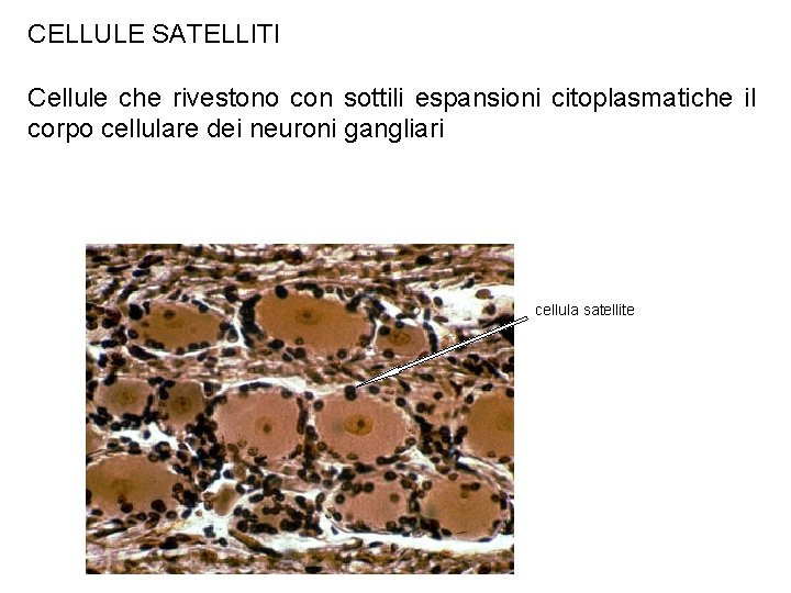 CELLULE SATELLITI Cellule che rivestono con sottili espansioni citoplasmatiche il corpo cellulare dei neuroni