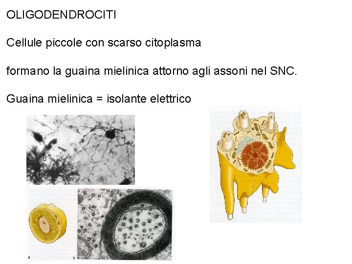 OLIGODENDROCITI Cellule piccole con scarso citoplasma formano la guaina mielinica attorno agli assoni nel