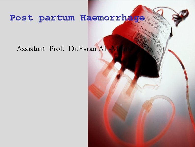 Post partum Haemorrhage Assistant Prof. Dr. Esraa AL-Maini 