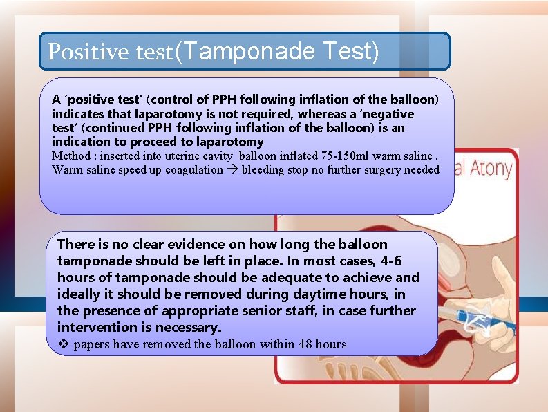 Positive test(Tamponade Test) A ‘positive test’ (control of PPH following inflation of the balloon)