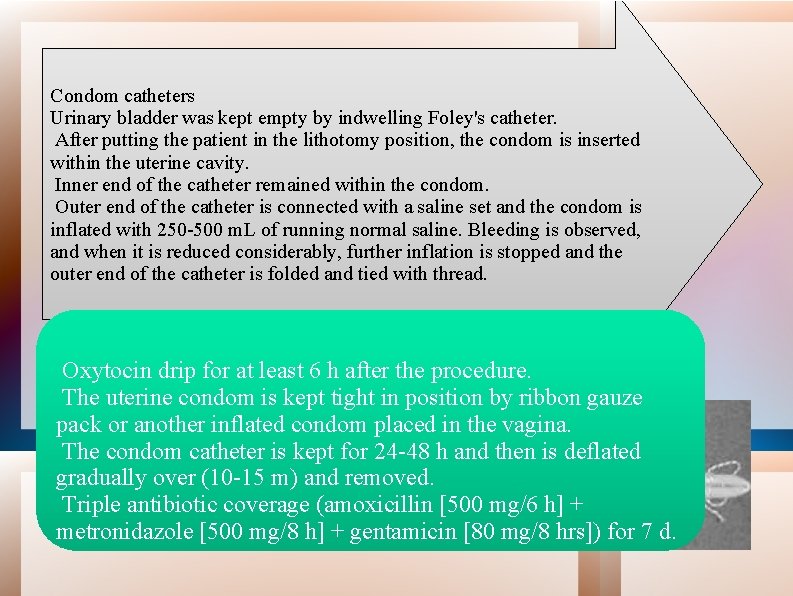 Condom catheters Urinary bladder was kept empty by indwelling Foley's catheter. After putting the