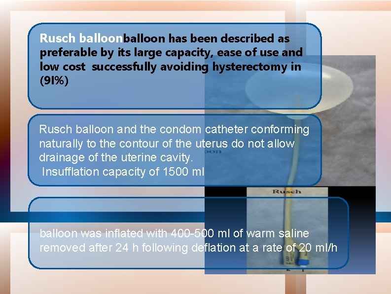 Rusch balloon has been described as preferable by its large capacity, ease of use