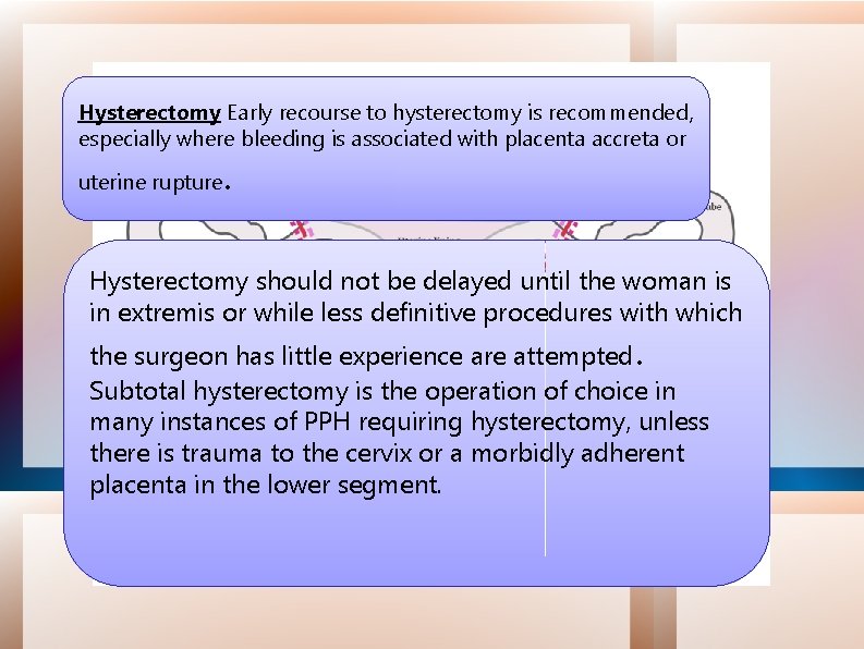 Hysterectomy Early recourse to hysterectomy is recommended, especially where bleeding is associated with placenta