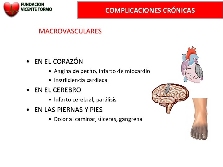 COMPLICACIONES CRÓNICAS MACROVASCULARES • EN EL CORAZÓN • Angina de pecho, infarto de miocardio