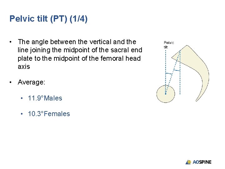 Pelvic tilt (PT) (1/4) • The angle between the vertical and the line joining