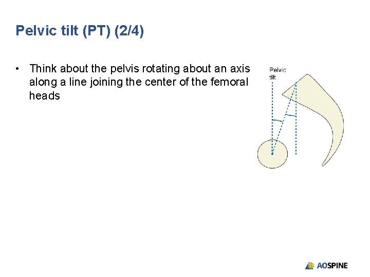 Pelvic tilt (PT) (2/4) • Think about the pelvis rotating about an axis along