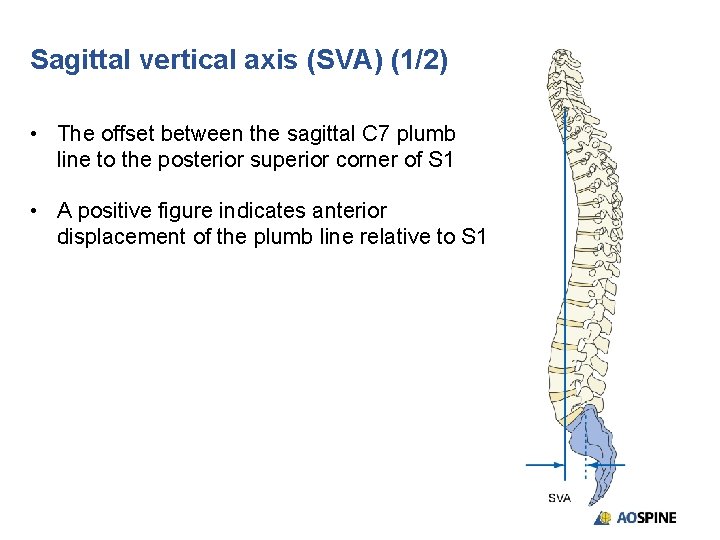 Sagittal vertical axis (SVA) (1/2) • The offset between the sagittal C 7 plumb