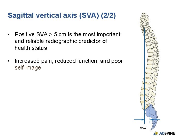 Sagittal vertical axis (SVA) (2/2) • Positive SVA > 5 cm is the most