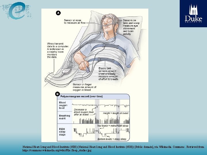 National Heart Lung and Blood Institute (NIH) (National Heart Lung and Blood Institute (NIH))