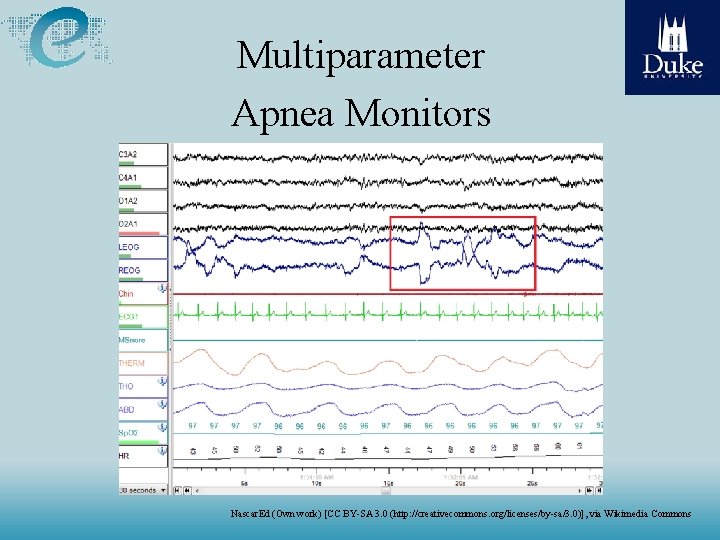 Multiparameter Apnea Monitors Nascar. Ed (Own work) [CC BY-SA 3. 0 (http: //creativecommons. org/licenses/by-sa/3.