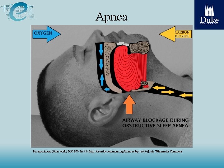 Apnea Drcamachoent (Own work) [CC BY-SA 4. 0 (http: //creativecommons. org/licenses/by-sa/4. 0)], via Wikimedia