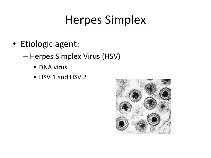 Herpes Simplex • Etiologic agent: – Herpes Simplex Virus (HSV) • DNA virus •