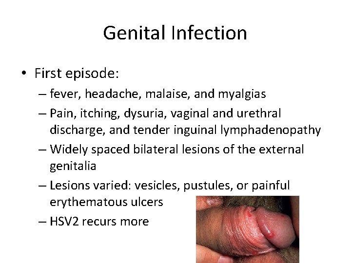 Genital Infection • First episode: – fever, headache, malaise, and myalgias – Pain, itching,