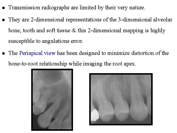 l Transmission radiographs are limited by their very nature. l They are 2 -dimensional