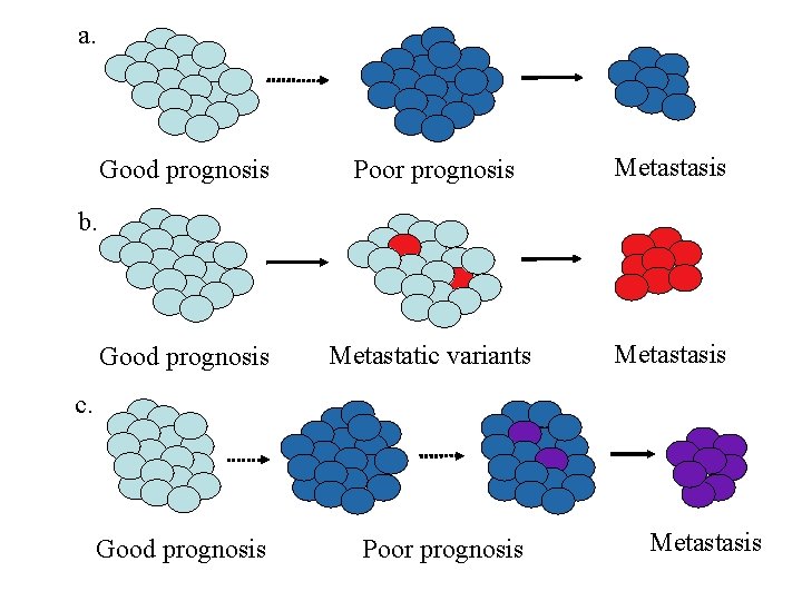 a. Good prognosis Poor prognosis Metastasis Good prognosis Metastatic variants Metastasis b. c. Good