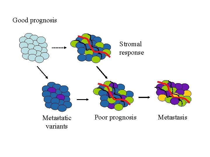 Good prognosis Stromal response Metastatic variants Poor prognosis Metastasis 