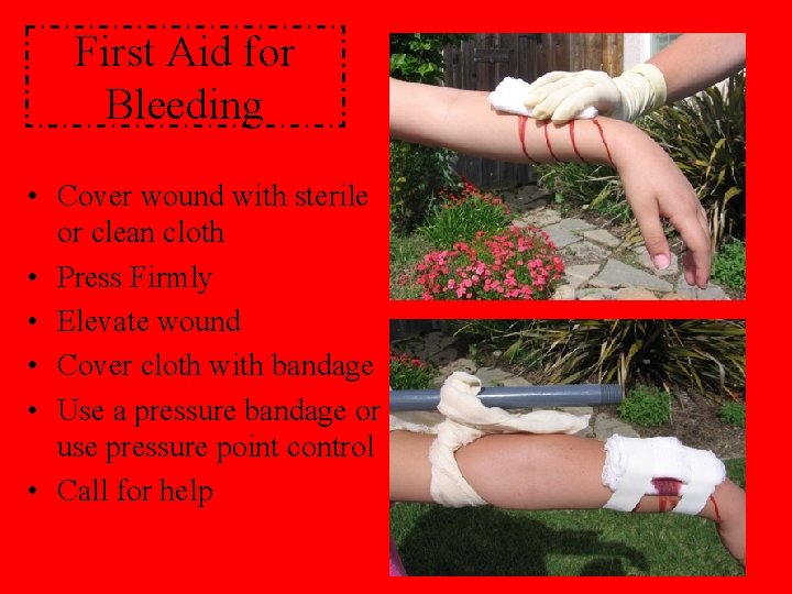 First Aid for Bleeding • Cover wound with sterile or clean cloth • Press