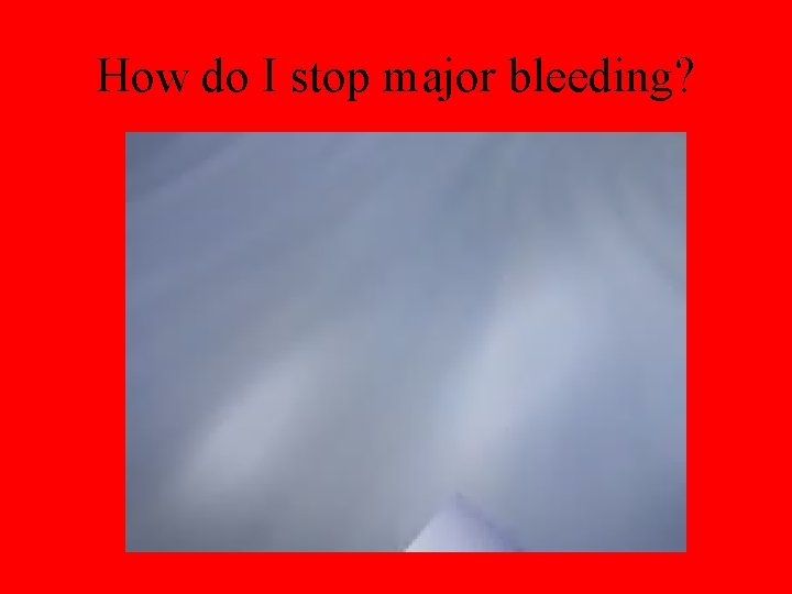 How do I stop major bleeding? 