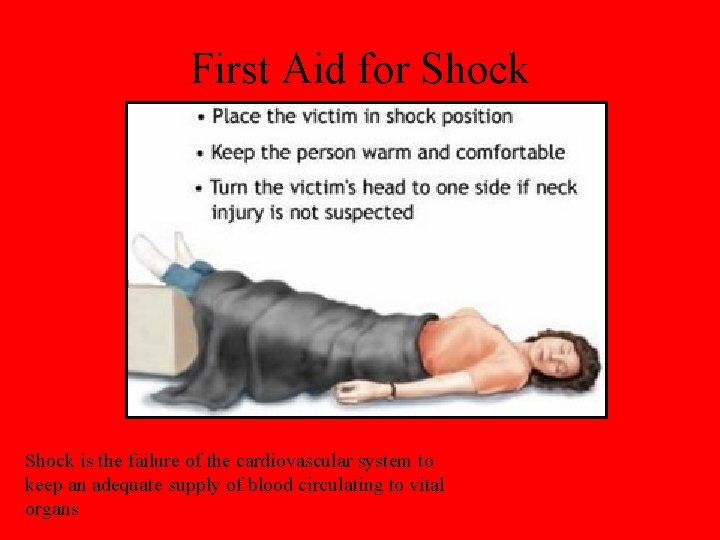 First Aid for Shock is the failure of the cardiovascular system to keep an