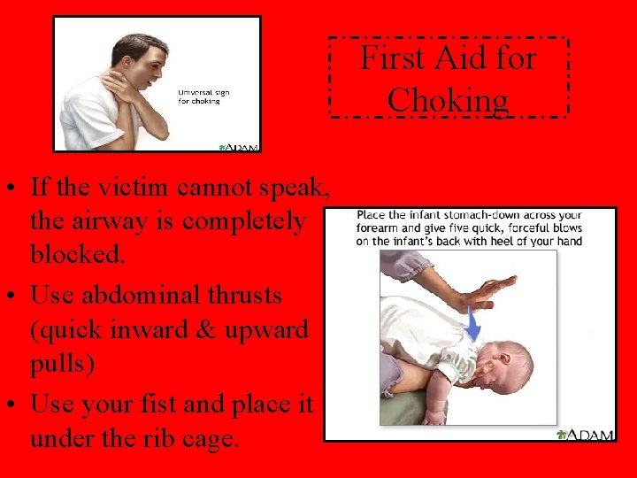 First Aid for Choking • If the victim cannot speak, the airway is completely