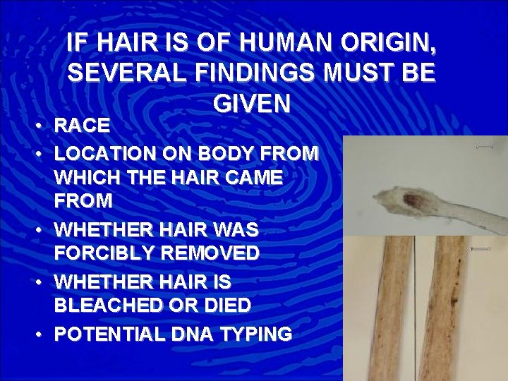 IF HAIR IS OF HUMAN ORIGIN, SEVERAL FINDINGS MUST BE GIVEN • RACE •