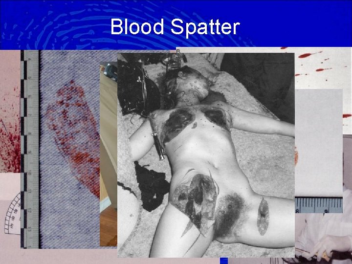 Blood Spatter 