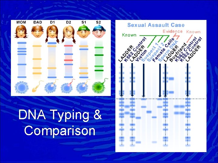 DNA Typing & Comparison 
