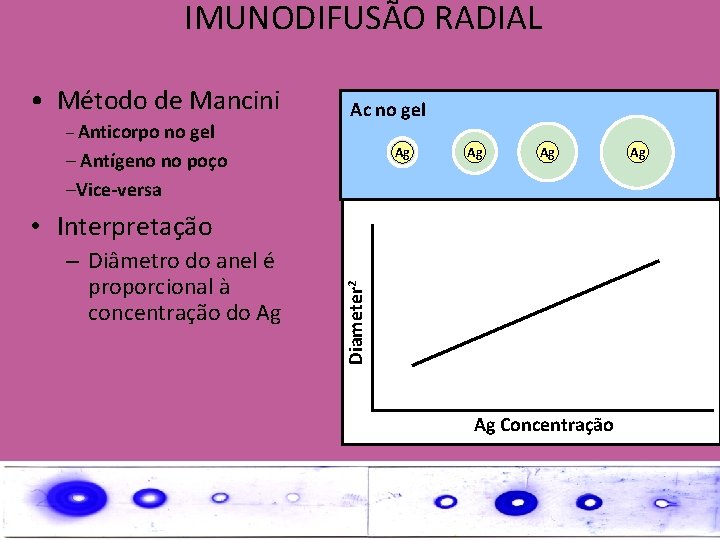 IMUNODIFUSÃO RADIAL • Método de Mancini – Anticorpo no gel Ac no gel Ag