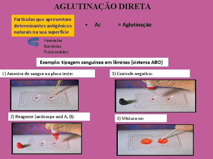 AGLUTINAÇÃO DIRETA Partículas que apresentam determinantes antigênicos naturais na superfície + Ac = Aglutinação