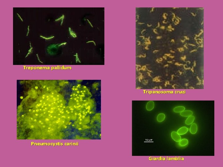 Treponema pallidum Tripanosoma cruzi Pneumocystis carinii Giardia lamblia 