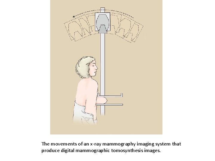 The movements of an x-ray mammography imaging system that produce digital mammographic tomosynthesis images.