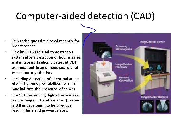 Computer-aided detection (CAD) • • CAD techniques developed recently for breast cancer The im