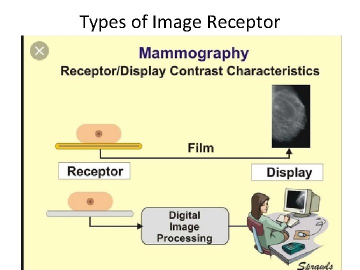 Types of Image Receptor 