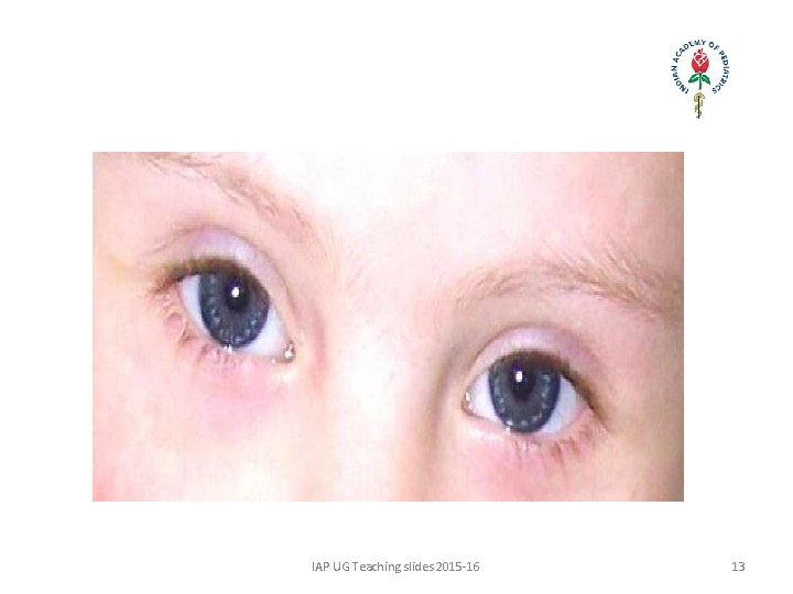 IAP UG Teaching slides 2015 -16 13 