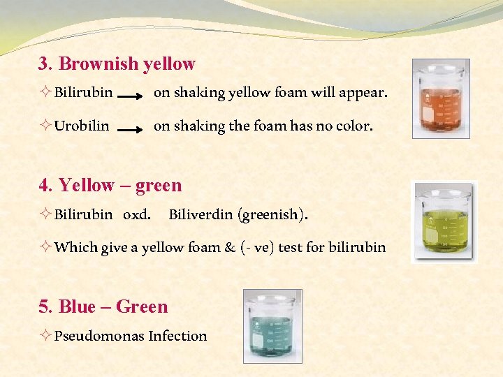 3. Brownish yellow ²Bilirubin ²Urobilin on shaking yellow foam will appear. on shaking the