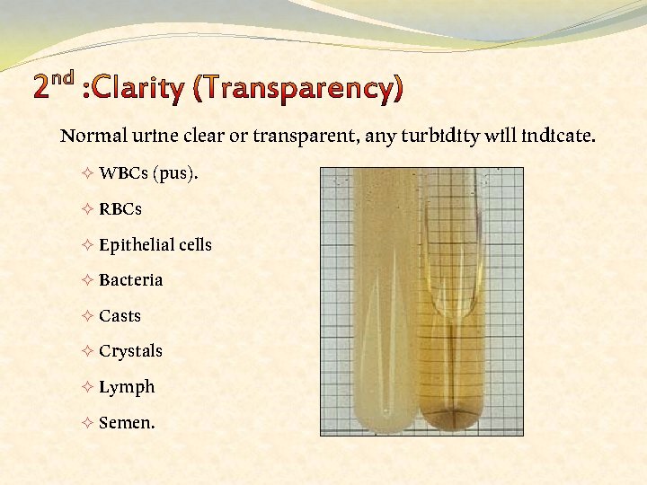 Normal urine clear or transparent, any turbidity will indicate. WBCs (pus). ² RBCs ²