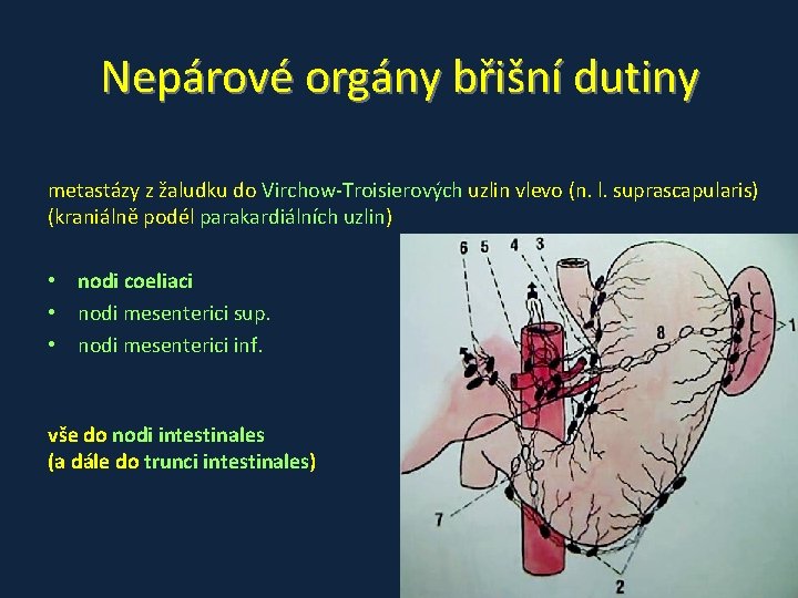 Nepárové orgány břišní dutiny metastázy z žaludku do Virchow-Troisierových uzlin vlevo (n. l. suprascapularis)